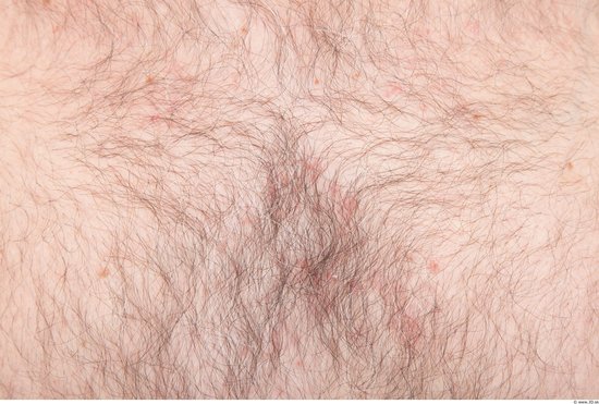 Hairy Skins