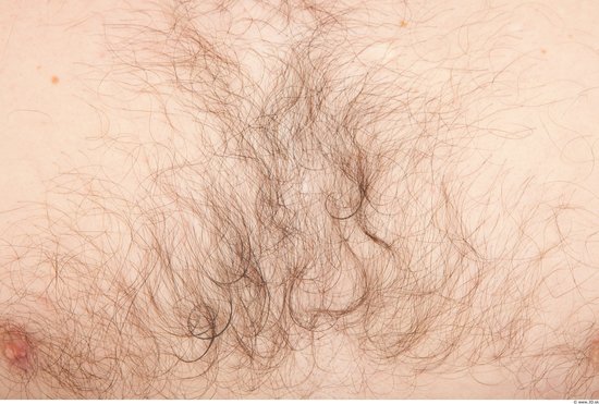 Hairy Skins