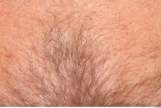 Hairy Skins