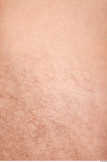 Hairy Skins