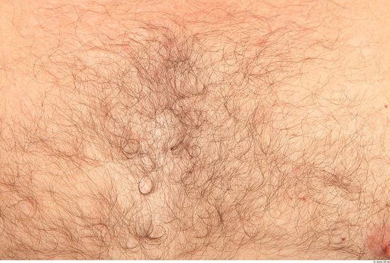 Hairy Skins