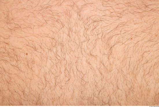 Hairy Skins