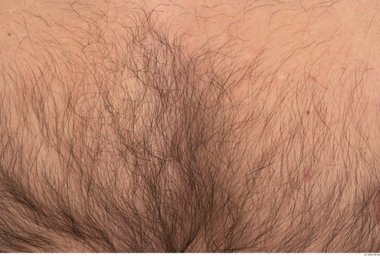 Hairy Skins