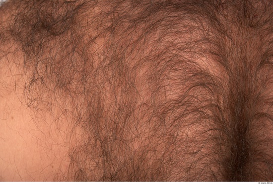 Hairy Skins