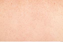 Photo Textures of Human Skin